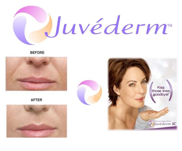 Juvederm