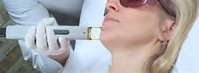 Lifetime Lip and Chin Laser Hair Removal package