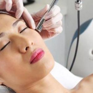 Microdermabrasion with a Chemical Peel + 10 FREE Units of Dysport